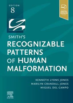 Smith's Recognizable Patterns of Human Malformation 8th 9780323638821 Front Cover