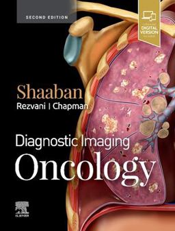 Diagnostic Imaging Oncology:  9780323661126 Front Cover