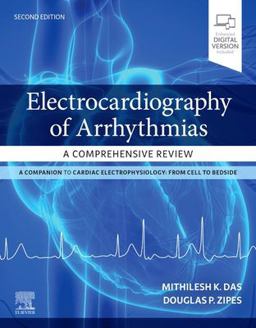Electrocardiography of Arrhythmias: a Comprehensive Review