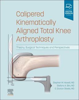 Calipered Kinematically Aligned Total Knee Arthroplasty Calipered Kinematically Aligned Total Knee Arthroplasty