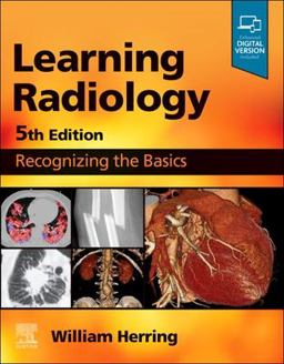 Learning Radiology Recognizing the Basics 5th 9780323878173 Front Cover