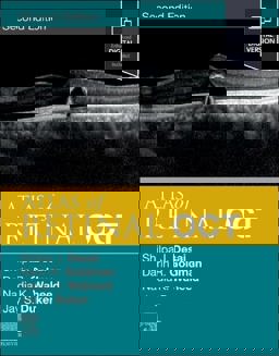 Atlas of Retinal OCT Optical Coherence Tomography 2nd 9780323930437 Front Cover