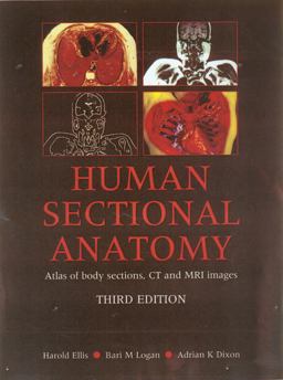 Human Sectional Anatomy Atlas of Body Sections, CT and MRI Images 3rd 9780340912225 Front Cover