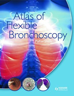 Atlas of Flexible Bronchoscopy  9780340968321 Front Cover