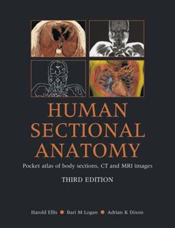 Human Sectional Anatomy Pocket Atlas of Body Sections, CT and MRI Images 3rd 9780340985168 Front Cover