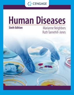 Human Diseases:  9780357618042 Front Cover