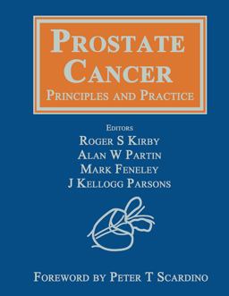 Prostate Cancer Prostate Cancer