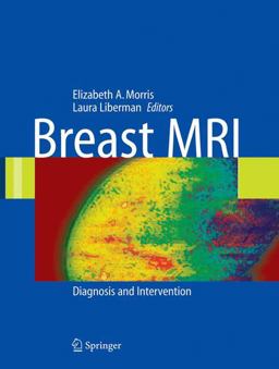 Breast MRI Diagnosis and Intervention  9780387219974 Front Cover