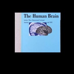 Human Brain : Surface, Three-Dimensional Sectional Anatomy and MRI 1st 1992 9780387822600 Front Cover