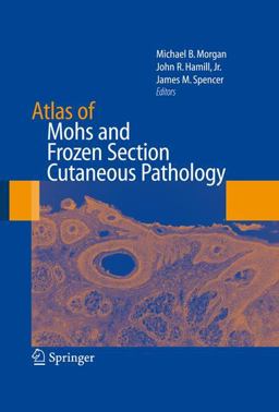 Atlas of Mohs and Frozen Section Cutaneous Pathology  9780387847993 Front Cover