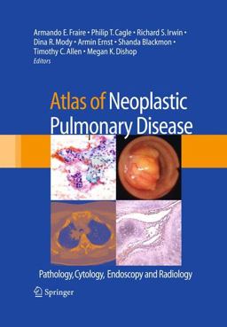 Atlas of Neoplastic Pulmonary Disease Pathology, Cytology, Endoscopy and Radiology  9780387898384 Front Cover
