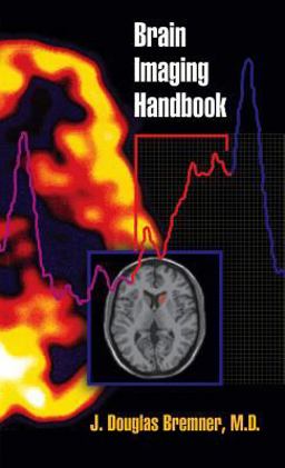 Brain Imaging Handbook  9780393704143 Front Cover
