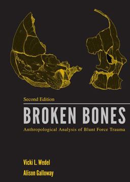 Broken Bones Anthropological Analysis of Blunt Force Trauma 2nd 9780398087685 Front Cover