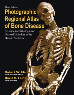 Photographic Regional Atlas of Bone Disease A Guide to Pathologic and Normal Variation in the Human Skeleton 3rd 9780398088262 Front Cover