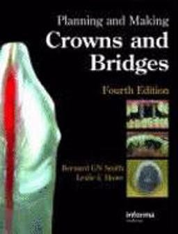 Planning and Making Crowns and Bridges 4th 9780415398503 Front Cover
