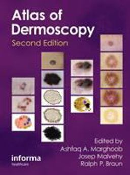 Atlas of Dermoscopy 2nd 9780415458955 Front Cover