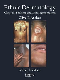 Ethnic Dermatology Clinical Problems and Skin Pigmentation 2nd 9780415471190 Front Cover