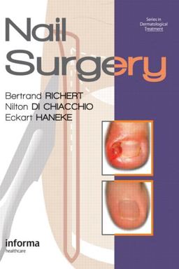 Nail Surgery  9780415472333 Front Cover