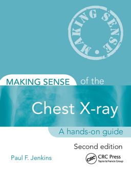 Making Sense of the Chest X-Ray