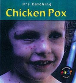 Chicken Pox
