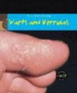 Warts and Verrucas