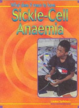 Sickle-Cell Anaemia