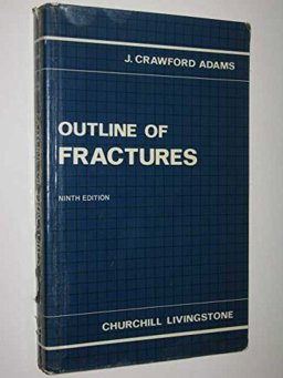 Outline of Fractures Outline of Fractures
