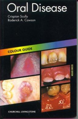 Oral Disease Oral Disease