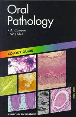 Oral Pathology Oral Pathology
