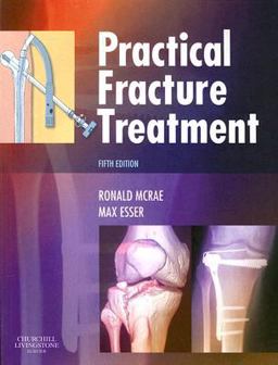 Practical Fracture Treatment 5th 9780443068768 Front Cover