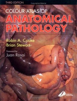 Colour Atlas of Anatomical Pathology 3rd 9780443073601 Front Cover
