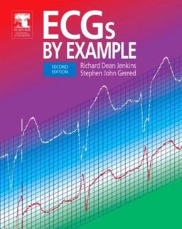 ECGs by Example