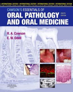 Cawson's Essentials of Oral Pathology and Oral Medicine