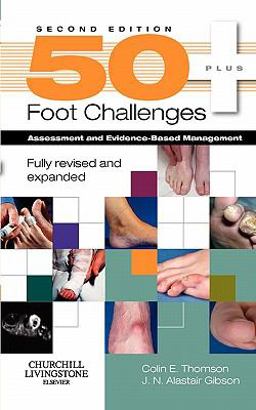 50+ Foot Challenges Assessment and Evidence-Based Management 2nd 9780443104022 Front Cover