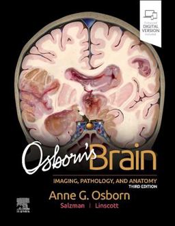 Osborn's Brain 3rd 9780443109379 Front Cover