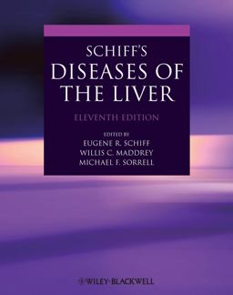 Schiff's Diseases of the Liver 11th 9780470654682 Front Cover