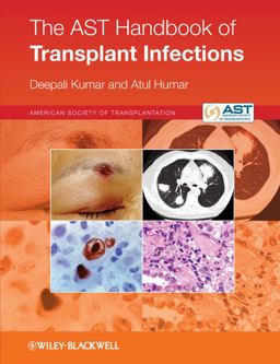AST Handbook of Transplant Infections 2nd 9780470658277 Front Cover