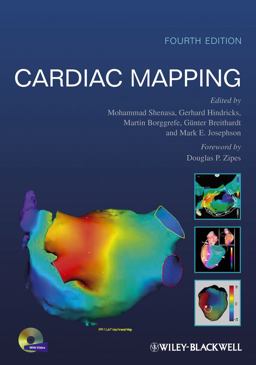 Cardiac Mapping Cardiac Mapping