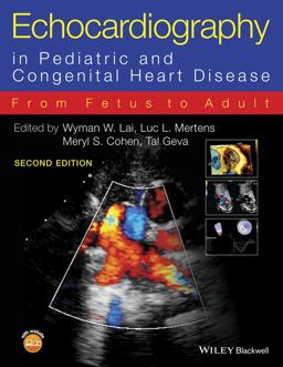 Echocardiography in Pediatric and Congenital Heart Disease From Fetus to Adult 2nd 9780470674642 Front Cover