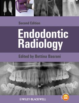Endodontic Radiology 2nd 9780470958490 Front Cover