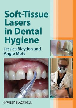 Soft-Tissue Lasers in Dental Hygiene  9780470958544 Front Cover