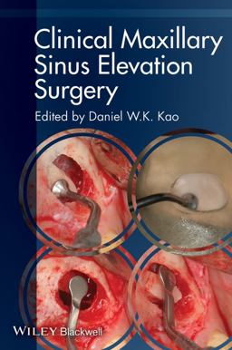 Clinical Maxillary Sinus Elevation Surgery  9780470960738 Front Cover