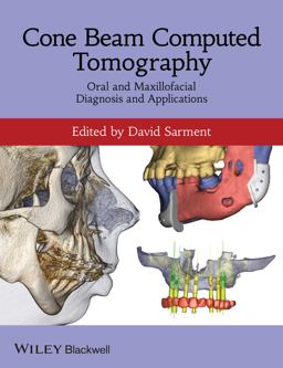 Cone Beam Computed Tomography Oral and Maxillofacial Diagnosis and Applications  9780470961407 Front Cover