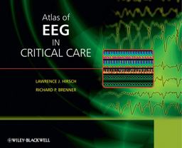 Atlas of EEG in Critical Care  9780470987865 Front Cover