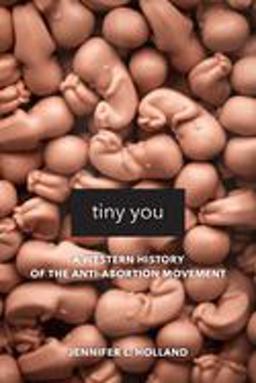 Tiny You A Western History of the Anti-Abortion Movement  9780520295872 Front Cover