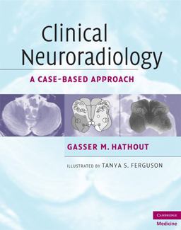 Clinical Neuroradiology A Case-Based Approach  9780521600545 Front Cover