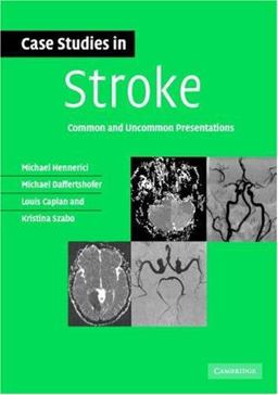 Case Studies in Stroke Common and Uncommon Presentations  9780521673679 Front Cover