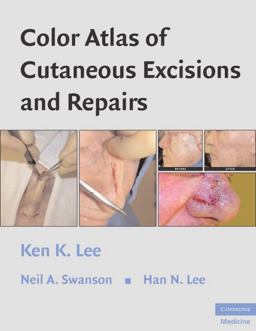Color Atlas of Cutaneous Excisions and Repairs  9780521860246 Front Cover