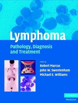 Lymphoma Lymphoma