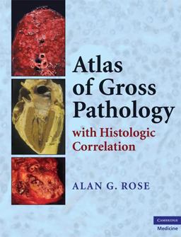 Atlas of Gross Pathology With Histologic Correlation  9780521868792 Front Cover